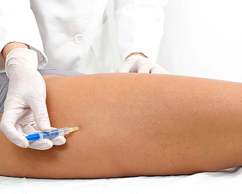 Mesoterapia